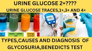 GLUCOSE SUGAR IN THE URINEBENEDICTS TESTGLUCOSE OXIDASE REAGENT STRIPSGLUCOSE 1GLUCOSE TRACES [upl. by Nelrah506]