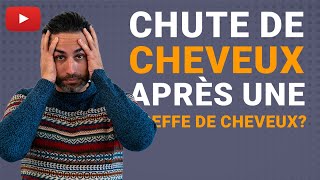 😱 Votre opération atelle échoué  Que faire en cas de perte de cheveux avec des croûtes [upl. by Druci]