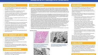 Drug induced acute interstitial nephritis [upl. by Kalbli400]