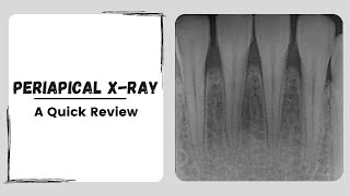 Periapical x ray  Intraoral Dental Radiograph [upl. by Allerus]