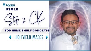 Top NBME Images Radiology  USMLE Step 2 CK 🩻 [upl. by Assyral]