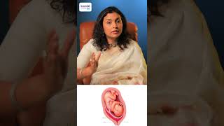 Low Lying Placenta இருந்தா பயப்பட வேண்டிய அவசியம் என்ன  DrPriya Kalyani [upl. by Ennove]