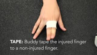 How do you treat a jammed finger [upl. by Howarth]