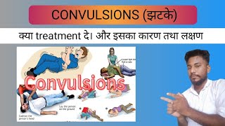 convulsions  झटके लगना का causes symptoms and treatment 🤷🤷 [upl. by Ennair]