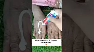 ✅️Clean Hand Dirt amp Tanning In 5minute  Hand Whitening Tipsshorts skincare beauty ytshorts🔥 [upl. by Lenno]