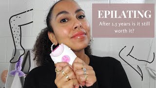 EPILATING AFTER 2 YEARS  IS IT STILL WORTH IT  HAIR REMOVAL [upl. by Nitsir]