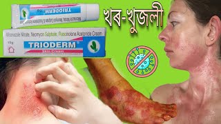 Trioderm Skin Cream Use and Side Effects in Assamese by Drx Kamal [upl. by Fu]