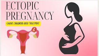 Ectopic Pregnancy The LifeThreatening Condition You Never Knew About [upl. by Cerf373]