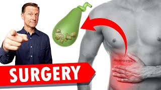 Gallbladder Surgery Removal WATCH THIS [upl. by Chancellor]