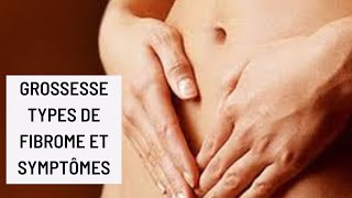 GrossesseTypes de fibrome et symptômes [upl. by Blodget]