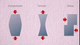 TV 2 Low Back Pain Biomechanics part 1 کمر درد، بیومکانیک کمر [upl. by Nalyt]