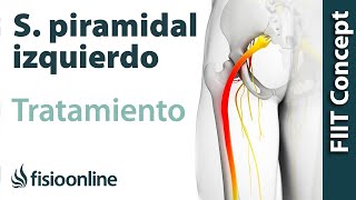 Tratamiento del síndrome piramidal izquierdo [upl. by Tomi]