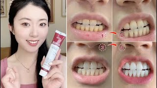 SP4TM Probiotic Whitening Toothpaste Review 2023Effectively remove bad breath and yellow teeth [upl. by Sousa779]