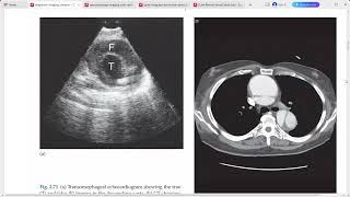 DIAGNOSTIC RADIOLOGY IMAGING [upl. by Elinet]