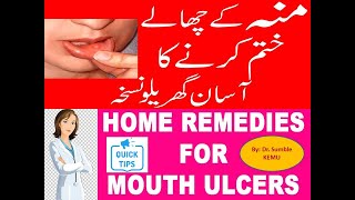 Mouth Ulcer blister Natural Remedies [upl. by Nnalyrehc268]