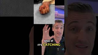 Trigger Finger Understanding Causes Symptoms and Treatments shorts [upl. by Oigroeg]