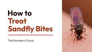 How to Treat Sandfly Bites Effectively Discover the Proven Method [upl. by Sherard]