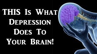 Brain Changes in Depression [upl. by Arza]