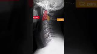 Anatomía de la columna cervical [upl. by Yeclehc320]