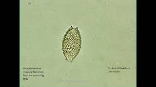 Trichuris trichiura Intestinal Nematode egg [upl. by Rramahs]