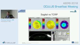 Prof Thomas Kohnen Pentacam® AXL [upl. by Retxab521]
