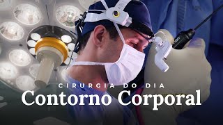 CONTORNO CORPORAL  Cirurgia do Dia Dr Samuel Orige [upl. by Lek]