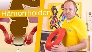 Hämorrhoiden ⚡️ Erkennen Behandeln amp Hilfsmittel [upl. by Towbin775]