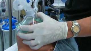 NT About Anesthesia Ch 5  General Anesthesia [upl. by Enirac919]