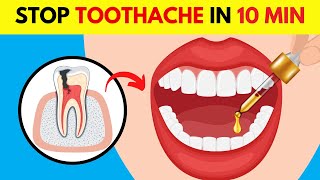 10 Quick amp Effective HOME REMEDIES for a TOOTHACHE [upl. by Nnahtur]