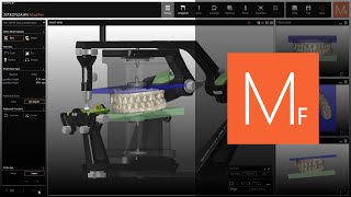 Verwendung des JawAligners im ZirkonzahnModifier  ZirkonzahnSoftware [upl. by Clein]