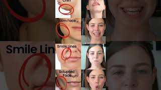 Face exercises to reduce face fat  get toned face with simple exercises shapeup [upl. by Naujet939]