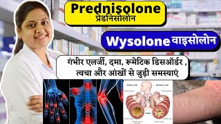 Prednisolone  Prednisone  गंभीर एलर्जी दमा रूमेटिक डिसऑर्डर  Wysolone  Wysolone 10 mg [upl. by Atsirk]