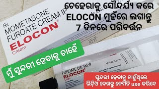 ମୁଁ ସୁନ୍ଦରୀ ହେବାକୁ ଚାହେଁ  Elocon  Mometasone Furoate Cream  ଚେହେରା ସୌନ୍ଦର୍ଯ୍ୟ ବଢ଼ାନ୍ତୁ 7ଦିନରେ [upl. by Maunsell194]