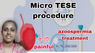 Micro TESE procedureকতটা painfulAzoospermia treatment in IVF [upl. by Repsaj]