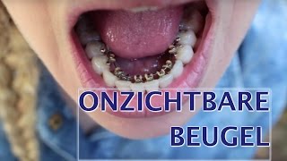 Onzichtbare beugel strakker zetten  FURROWNL [upl. by Queena660]