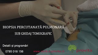 Biopsia percutanată pulmonară sub ghidaj tomografic  dr Radu Dumitru Centrul Medical Provita [upl. by Randi]