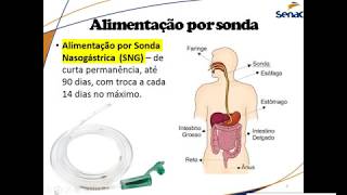 Sonda Alimentares [upl. by Thurlow]