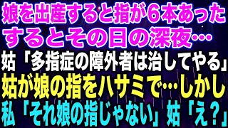 【スカッとする話】娘を出産すると指が６本あったするとその日の深夜…姑「多指症の障外者は治してやる」姑が娘の指をハサミで…しかし私「それ娘の指じゃない」姑「え？」 [upl. by Anyr327]