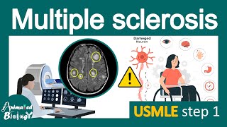 Multiple Sclerosis  Pathology Immunology  diagnosis and treatment of MS  USMLE step 1 [upl. by Barbabra]