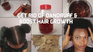 HOW TO GET RID OF DANDRUFF AND ACHIEVE MASSIVE HAIR GROWTH WITH BAYLEAF  BAYLEAF TEA [upl. by Feeley]