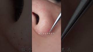 immersive skin care strawberry nose blackhead deep pore cleaning skin management [upl. by Nnylireg]