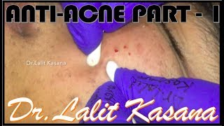 ANTI ACNE TREATMENT part1 [upl. by Bruno]