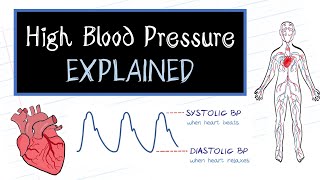 What is High Blood Pressure HealthSketch [upl. by Eatnoj]