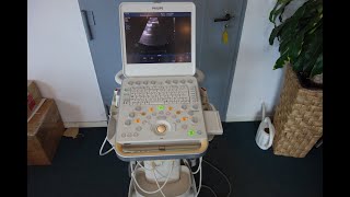 Philips CX50 portables Ultraschallgerät mit 3 Sonden und Cart wwwusedmedicalequipmentde [upl. by Deloria]