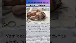 Vernix caseosa Norcet 08 important image Base mcq  Maternity nursingytviralshort [upl. by Avle648]