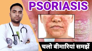 psoriasis kya hai how to treat psoriasis ❤️💥💯 raheesansari [upl. by Bron]