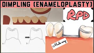 DIMPLING ENAMELOPLASTY II PROSTHETIC MOUTH PREPARATION II REMOVABLE PARTIAL DENTURE I PROSTHODONTICS [upl. by Hahnke]