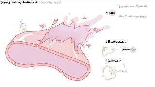 How to diagnose haemolytic anaemia [upl. by Qifar237]