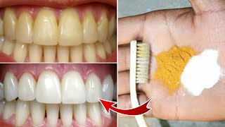 Simple natural way to whiten teeth at home using baking soda [upl. by Airlie]