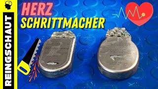 Herzschrittmacher  Defibrillator ZERLEGT [upl. by Nyledam]